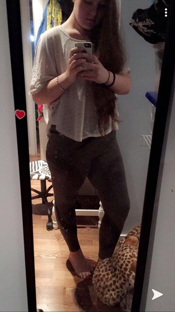 Sarah Peters after weight loss surgery